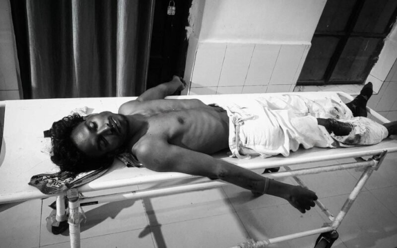 सोनुवा मुख्य मार्ग पर सड़क हादसा, तीन युवक घायल; एक की हालत गंभीर