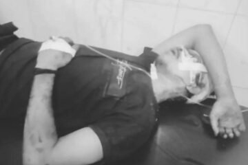 बारीगोरा में युवक पर चापड़ और पत्थर से जानलेवा हमला, गंभीर हालत में एमजीएम अस्पताल रेफर