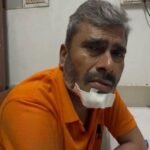 संदिग्ध सड़क हादसे के बाद रेलकर्मी की स्कूटी, ₹25 हजार नकद और सामान गायब, लूटपाट की आशंका