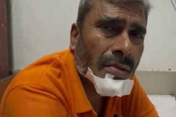 संदिग्ध सड़क हादसे के बाद रेलकर्मी की स्कूटी, ₹25 हजार नकद और सामान गायब, लूटपाट की आशंका